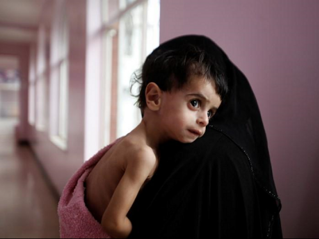 Additional one million children at risk of famine in Yemen, report shows